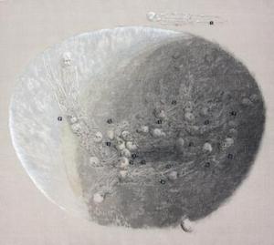 발굴-A
