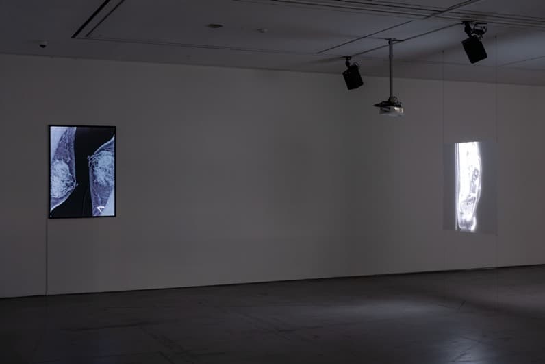 <싹 다 살아졌음> 전시전경 · Exhibition view
