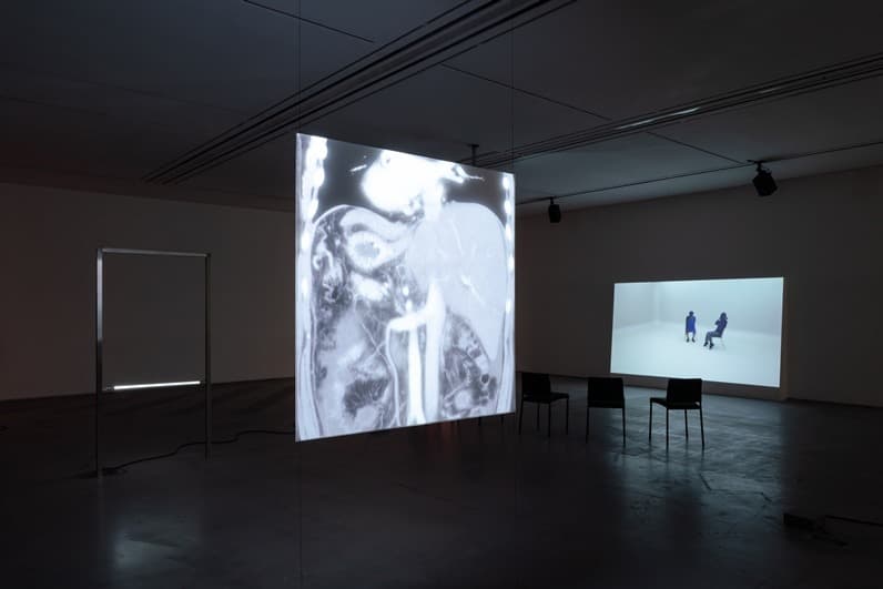 <싹 다 살아졌음> 전시전경 · Exhibition view