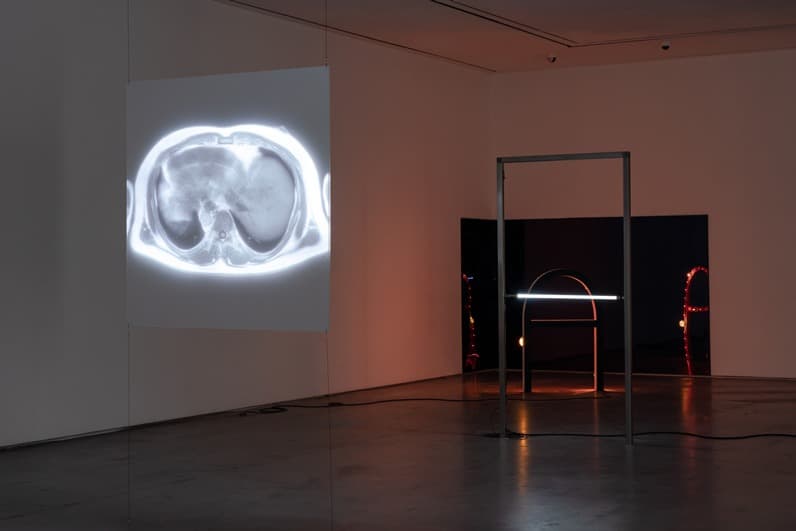 <싹 다 살아졌음> 전시전경 · Exhibition view