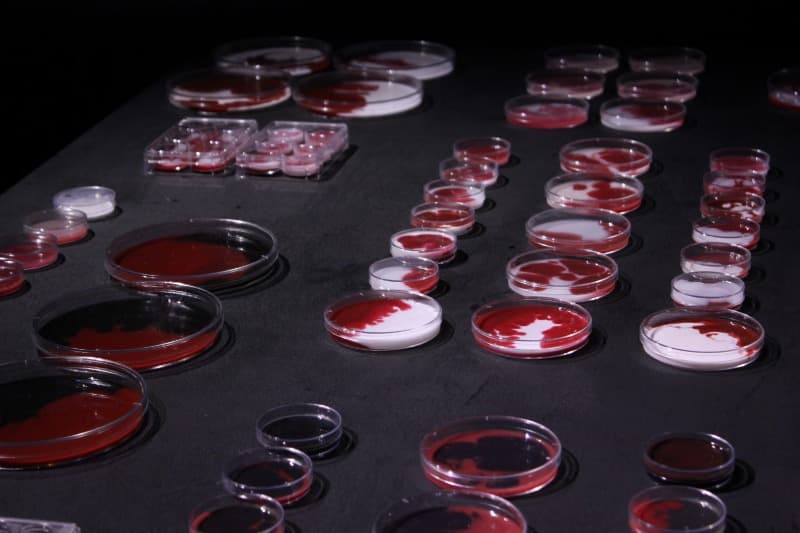 종 · silicone, petri dish · variable installation · 2021 (출처= 아트포럼리)