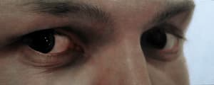 The Eye